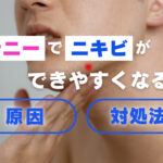 オナニーでニキビができやすくなる原因と対処法!おなニキビを作らない!